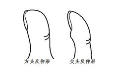 手相二婚线在哪里