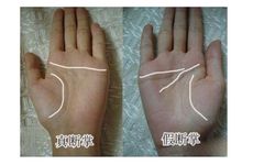 断掌两个双手断掌的男人命运