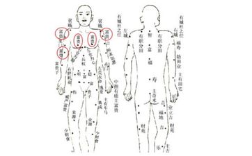 痣长在哪里有福气